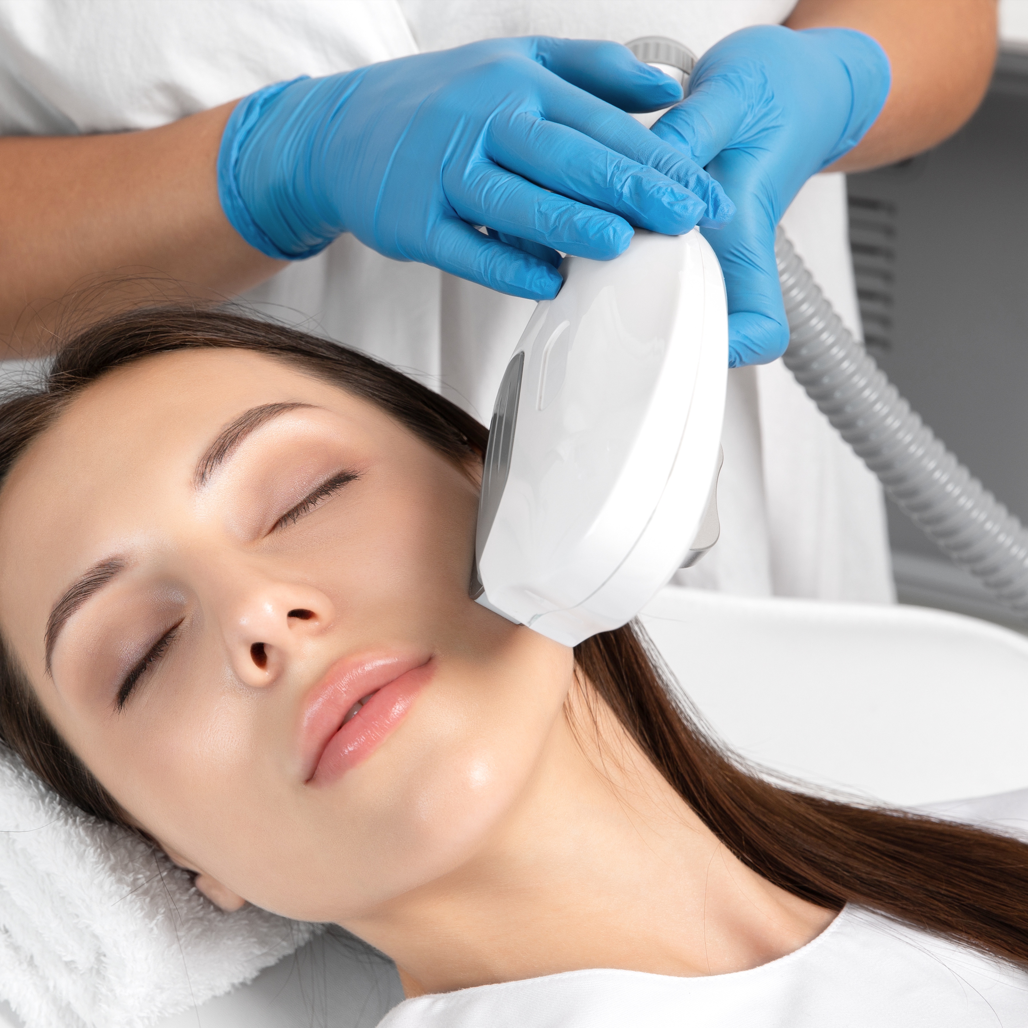 Acne Recovery Laser Facial at 360 Med Spa Buford in Buford, GA