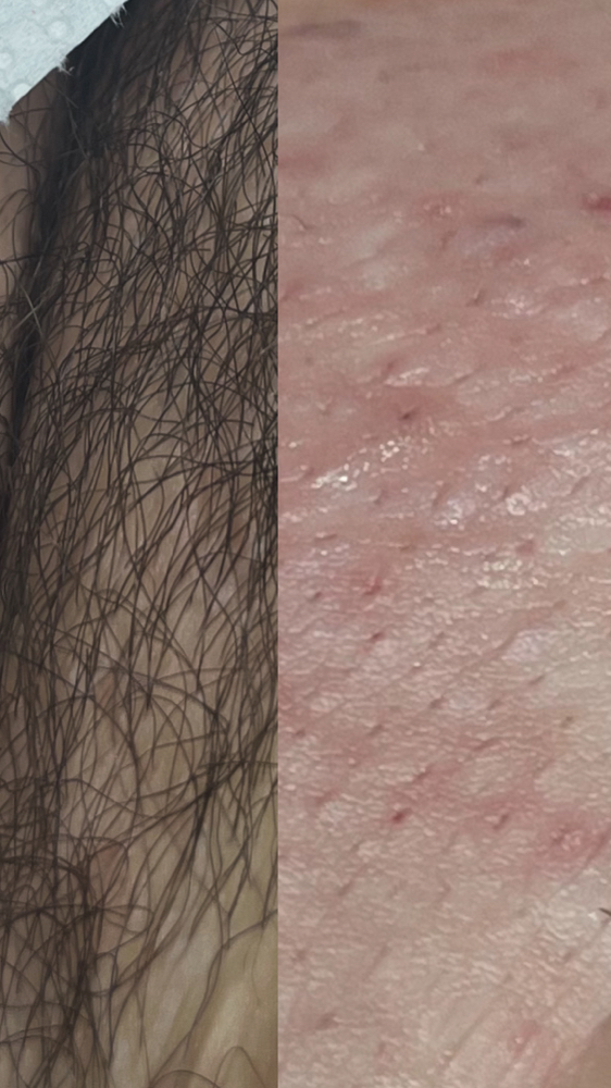 Brazilian Wax