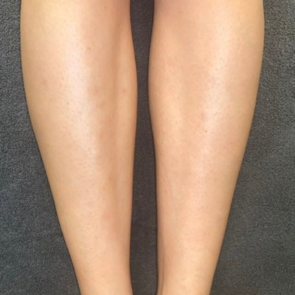 Full Leg
