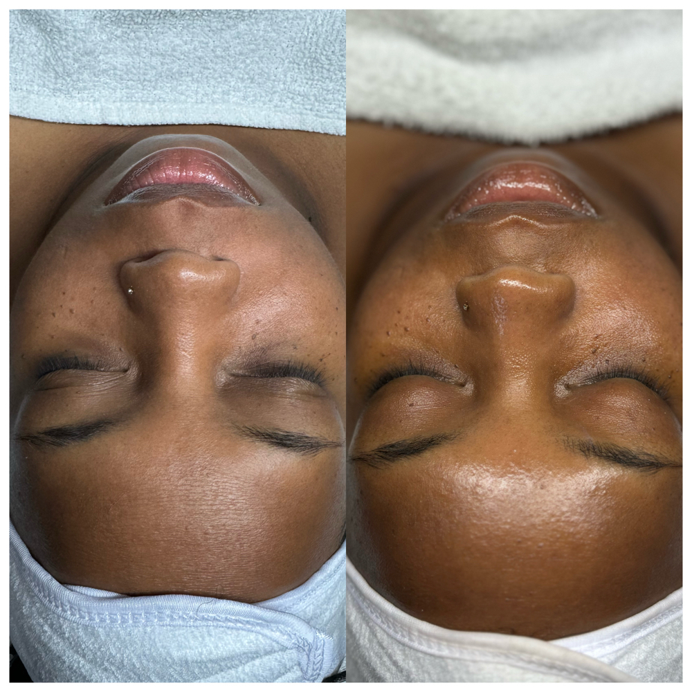 Custom Facial (Returning Clients) at AuraGlow Skinlab in Phoenix, AZ