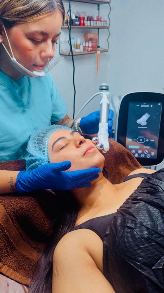 Rejuvenecimiento Fraccional at Soulmates Studio in Richmond, VA