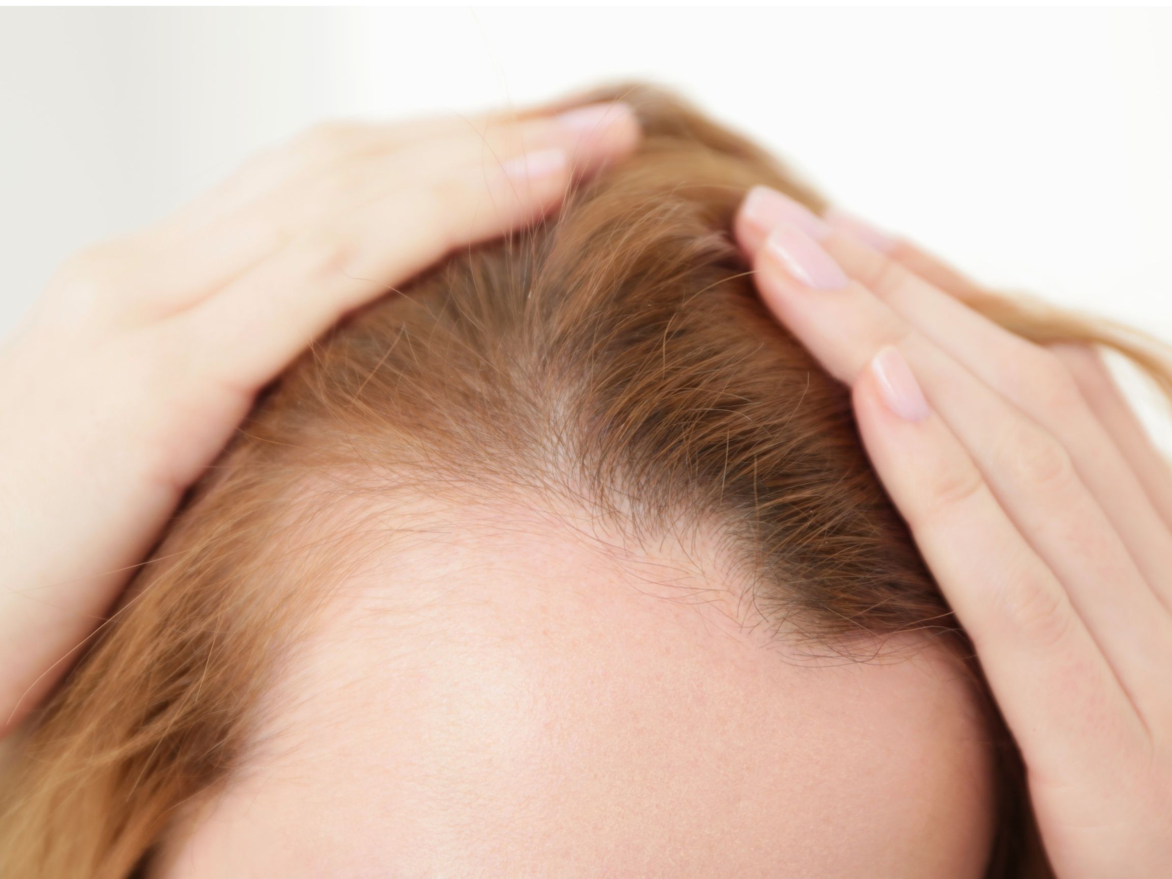 Thinning Hair Treatment