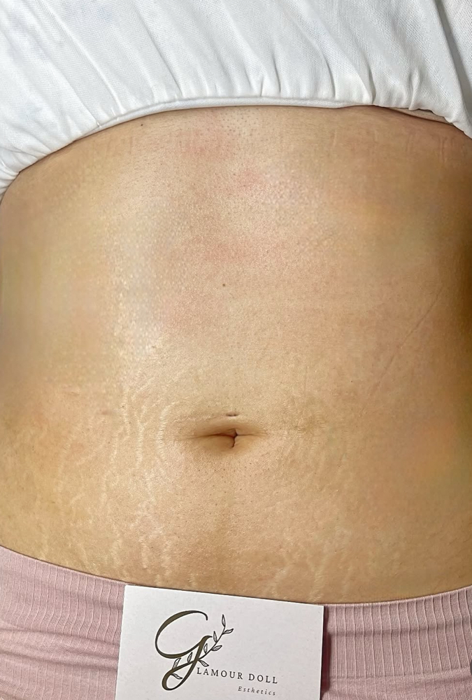 Stomach