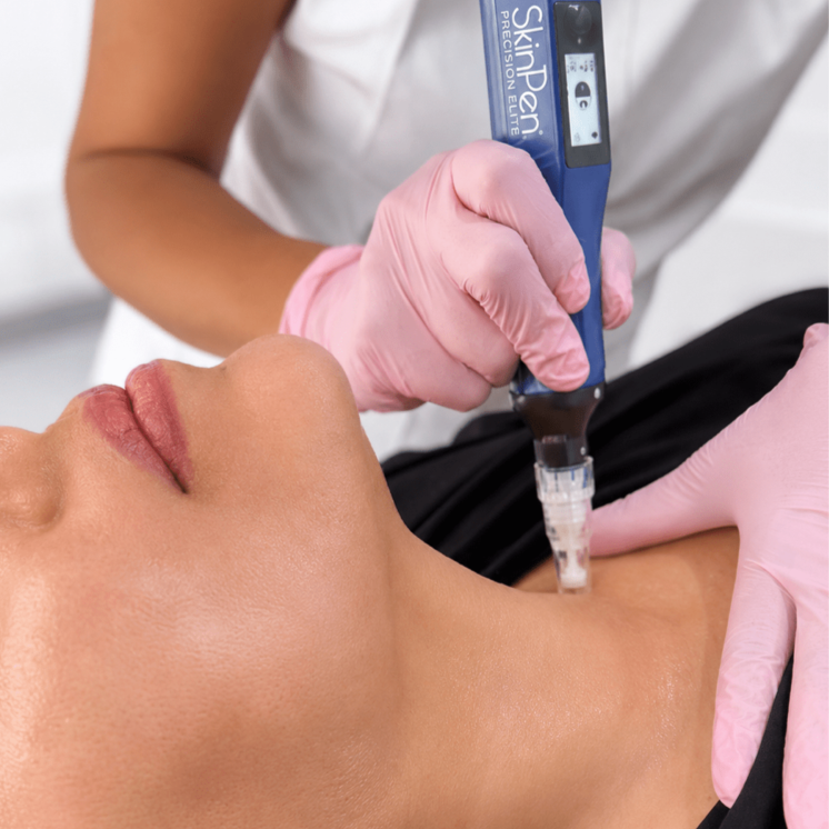 RF Microneedling Neck Region at JENNVIE Med Spa in Westport, CT