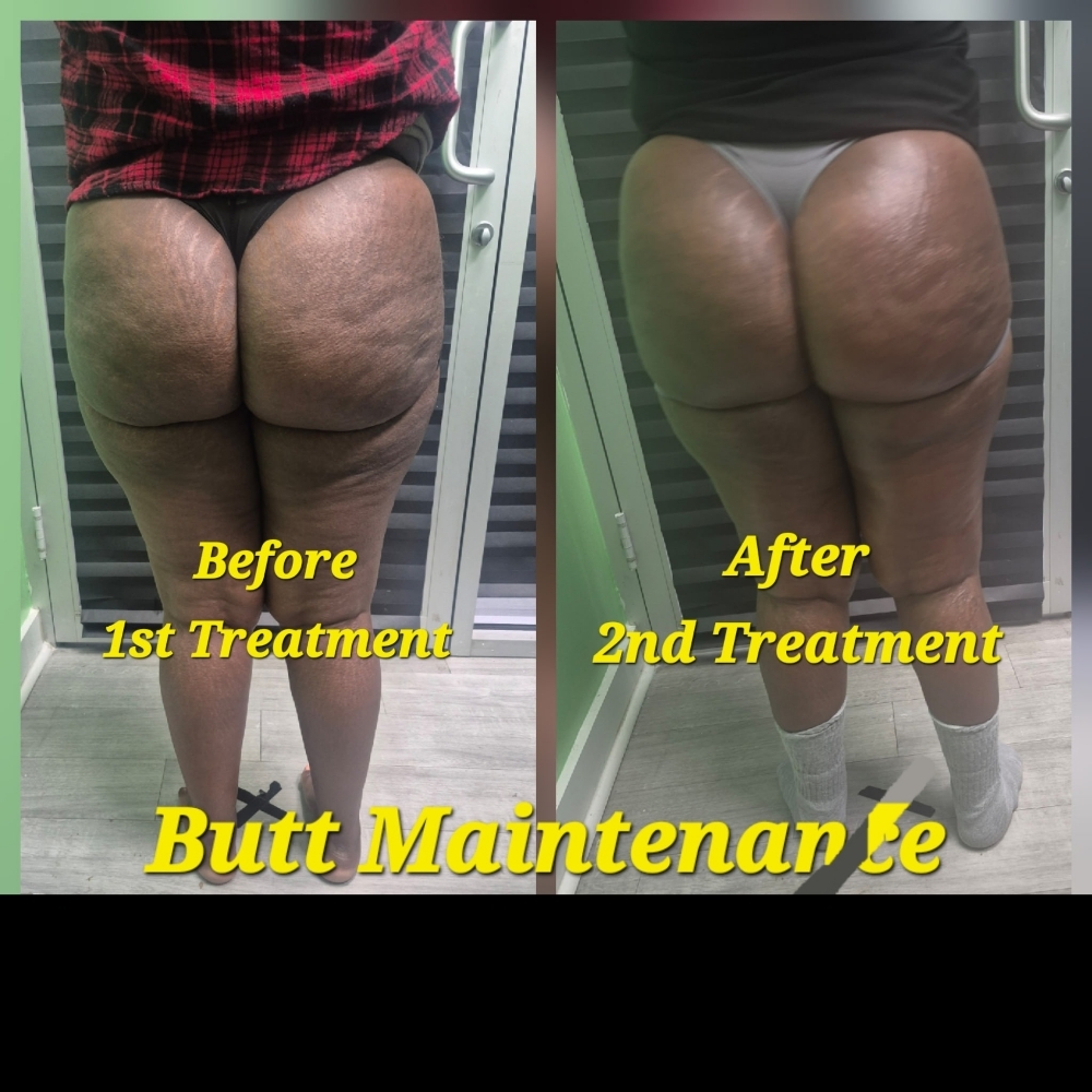 🍑 Butt Maintenance + Butt Glow at JUST BEAUTIFUL SKIN in Goose Creek, SC