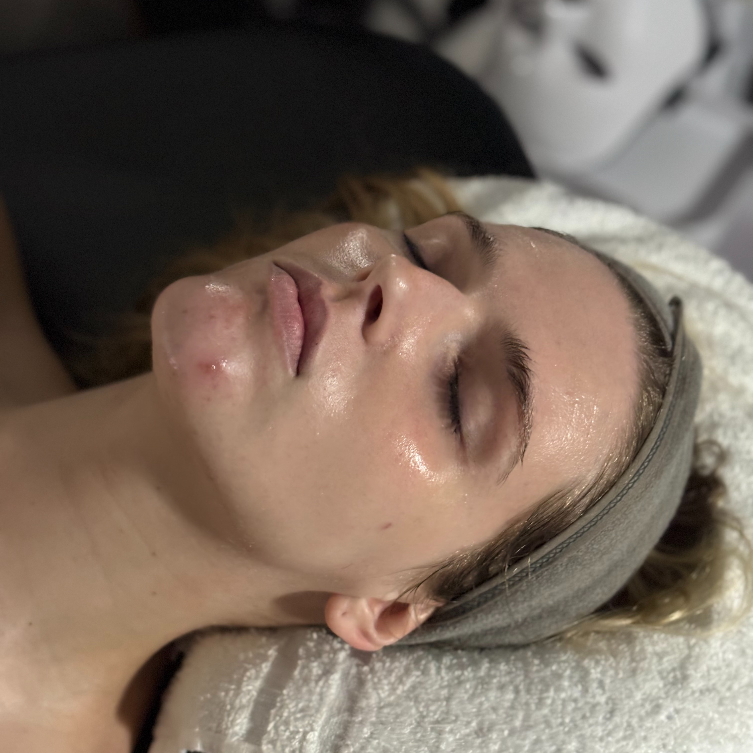 Refine Facial at Evermore Esthetics in Lebanon, OH