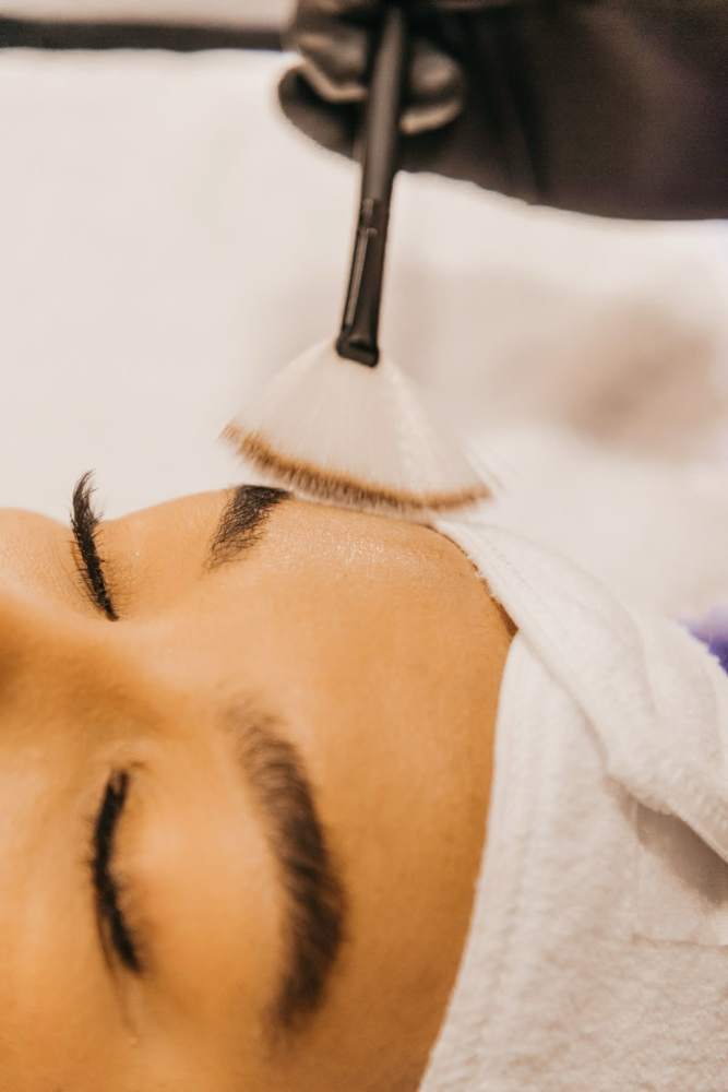 Alpha Beta Chemical Peel at Bare Esthetics Medical Spa LLC in Idabel, OK