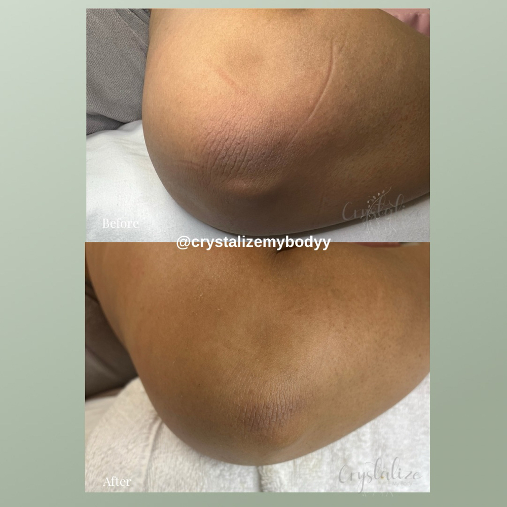 Skin Brightening (1 Session)