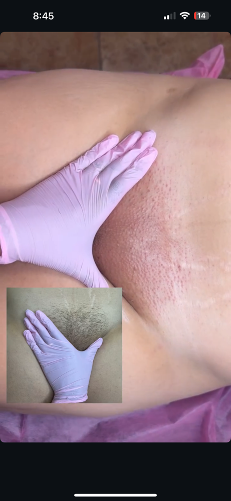 Brazilian + Exfoliating&Hydro Mask