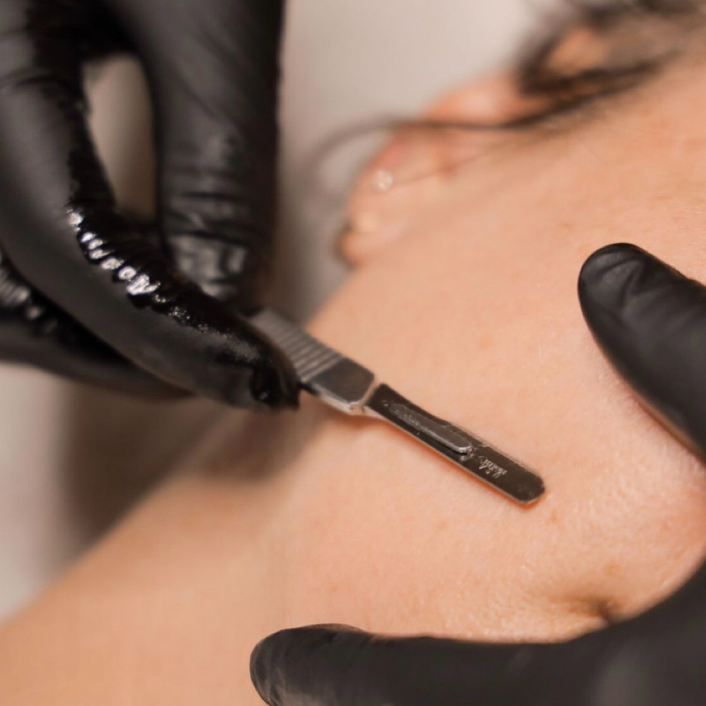 Dermaplane Facial Add On at The Beauty Lab in Williamsville, NY