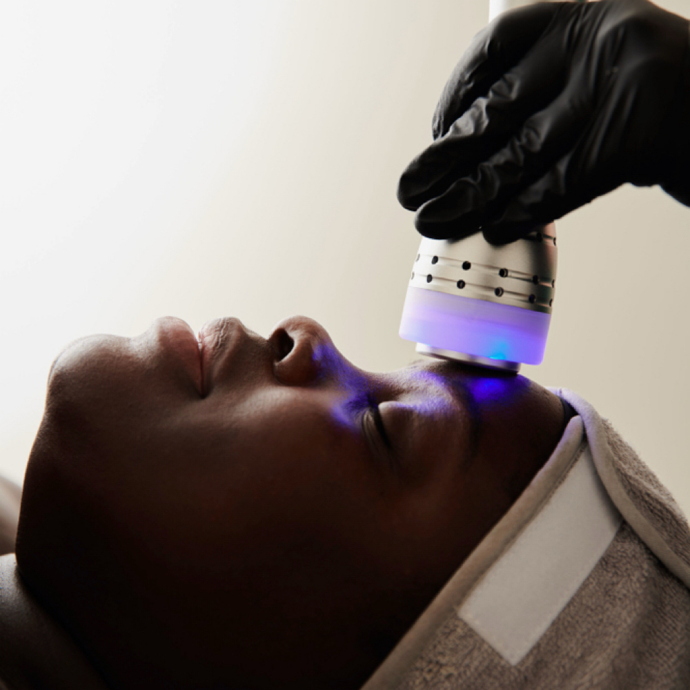 Microlift Skin Tightening