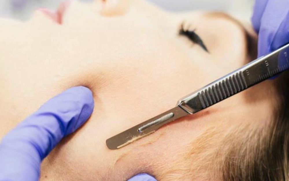 Dermaplaning Facial