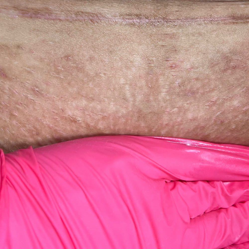 6 Month Brazilian Wax at The Este Lounge in Hanford, CA