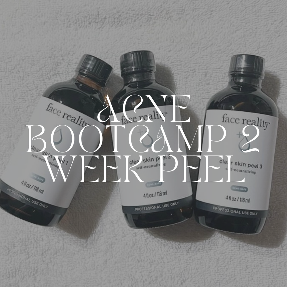 Acne Bootcamp 2 Week Peel