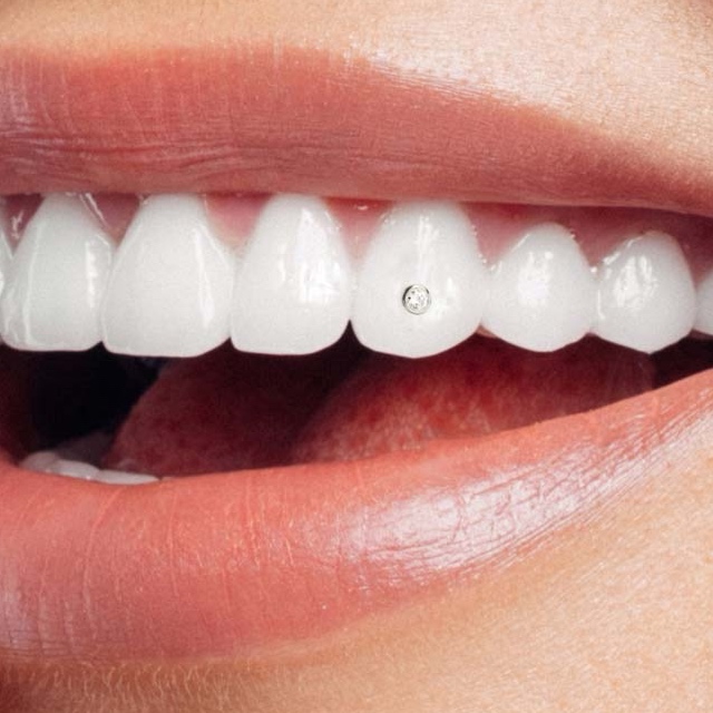 Tooth Gems - Single at Rise Beauty Studio in Forest Grove, OR