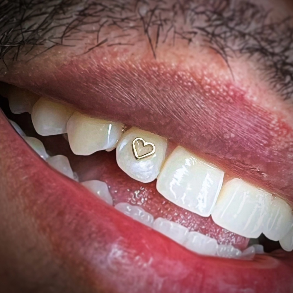 Single 22k Gold Tooth Gem