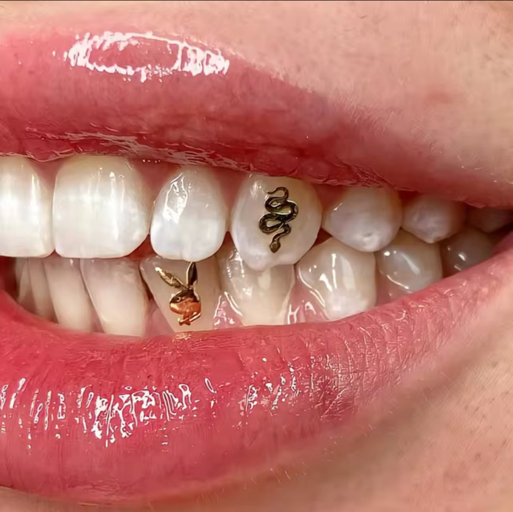 18k Gold Tooth Gem(s)