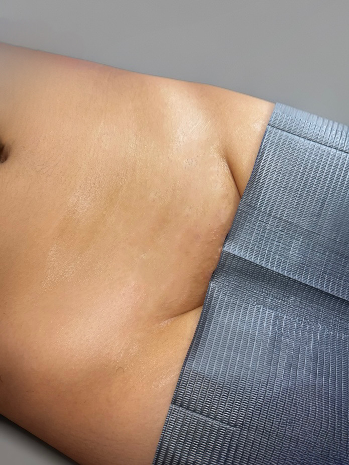 Brazilian Wax