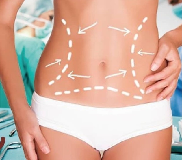 Lymphatic Massage ( Tummy Tuck)