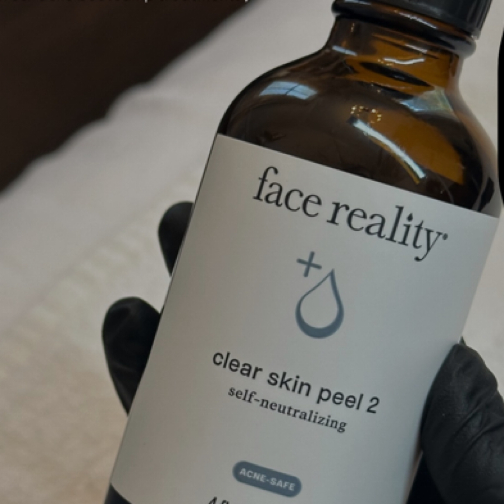acne program bundle at 828aesthetics in Henderson, NV