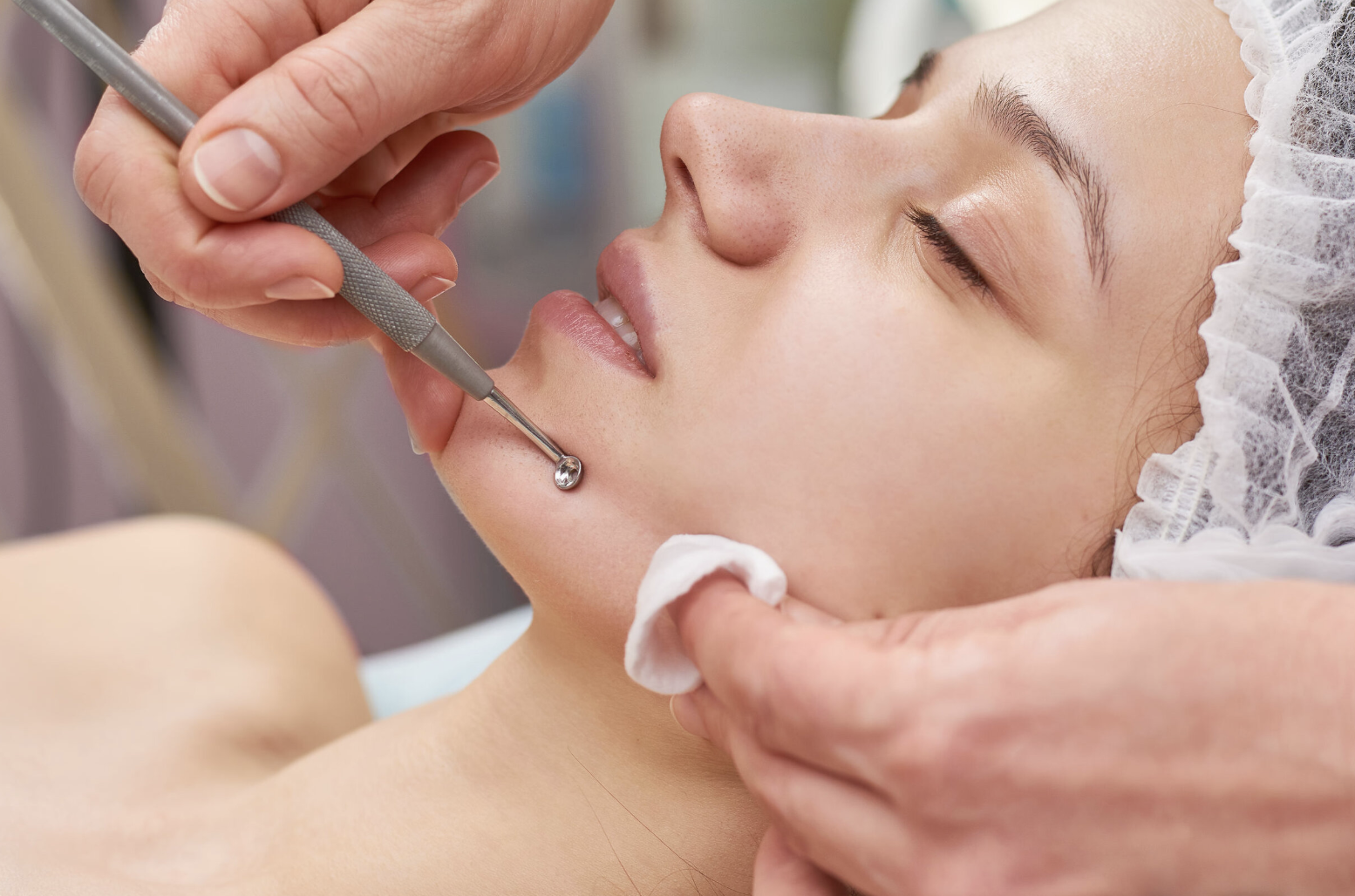 Extractions -Add on
