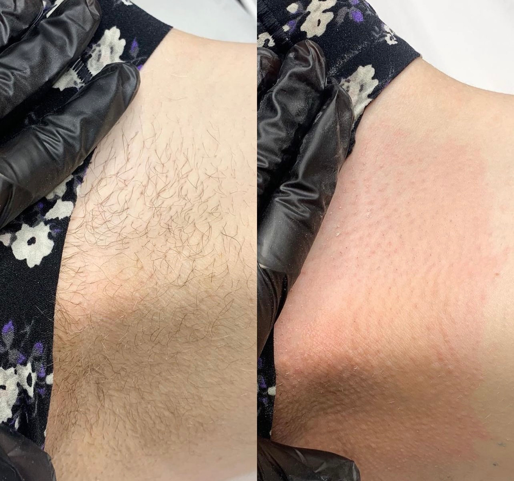 Bikini Line Wax