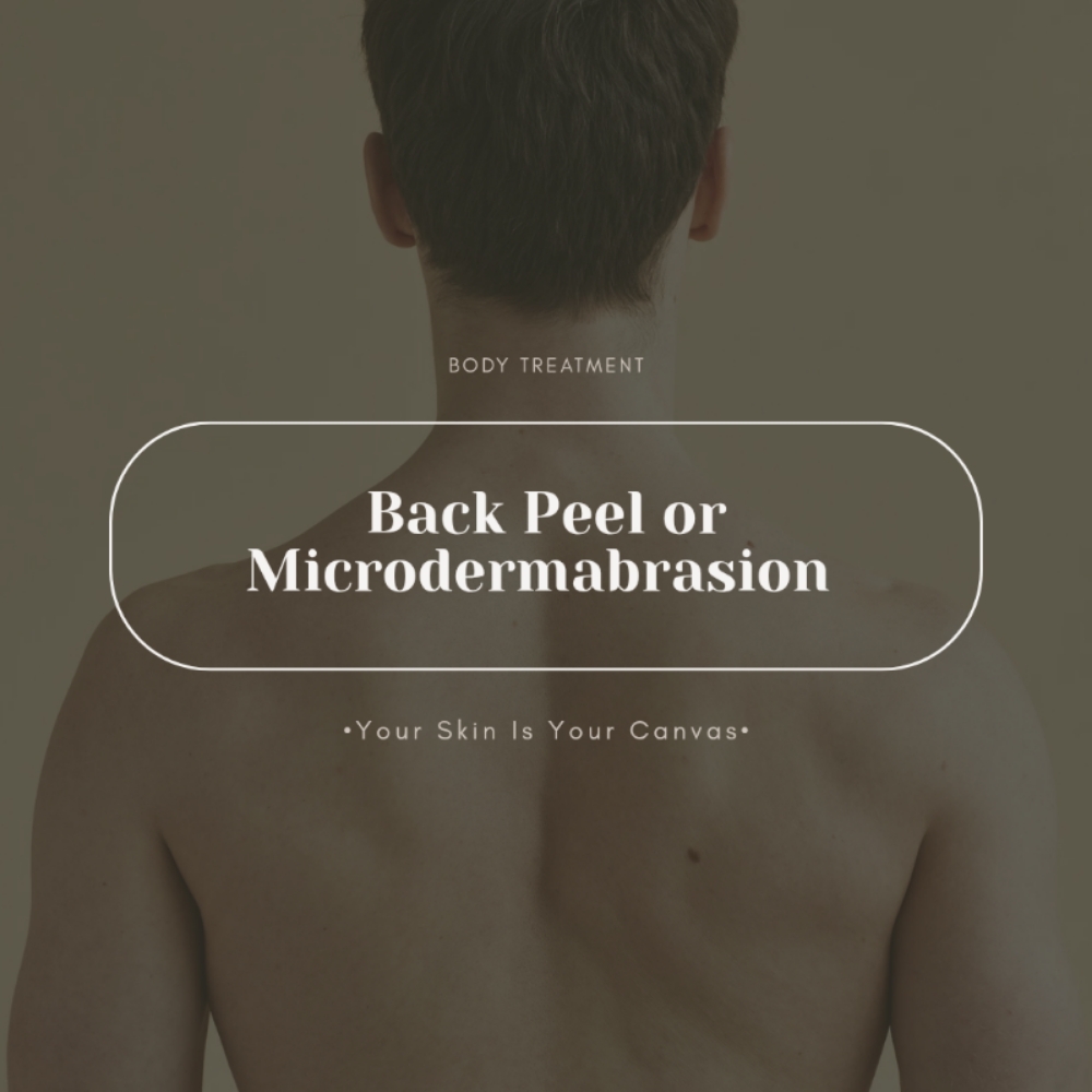 Back Peel Or Microdermabrasion at Face Palette Aesthetics in Franklin, WI