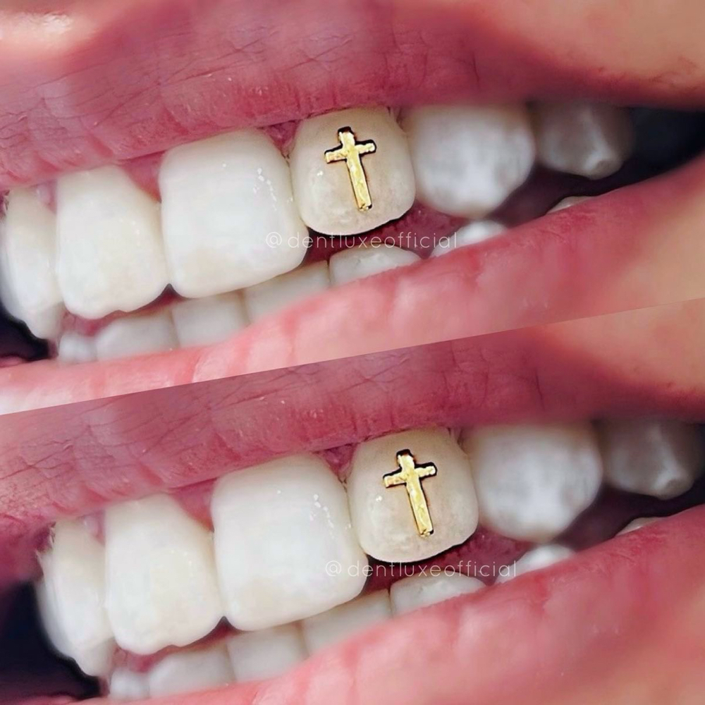 Tooth Charms