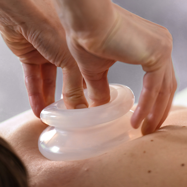 Cupping Therapy