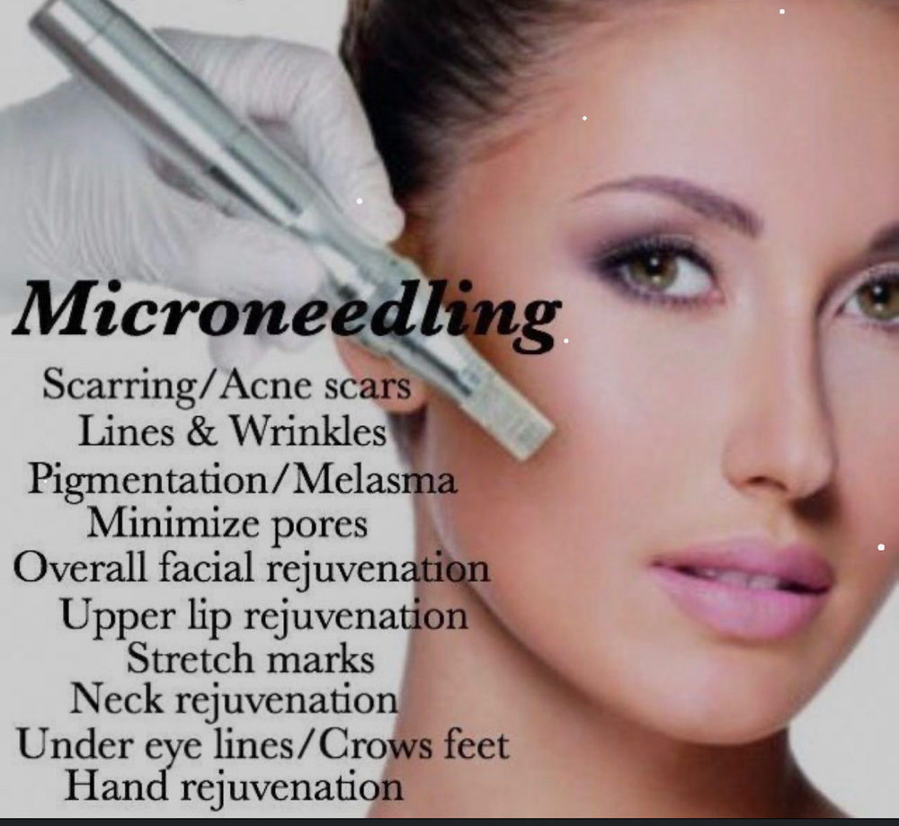 MICRO NEEDLING COLLAGEN INDUCTION