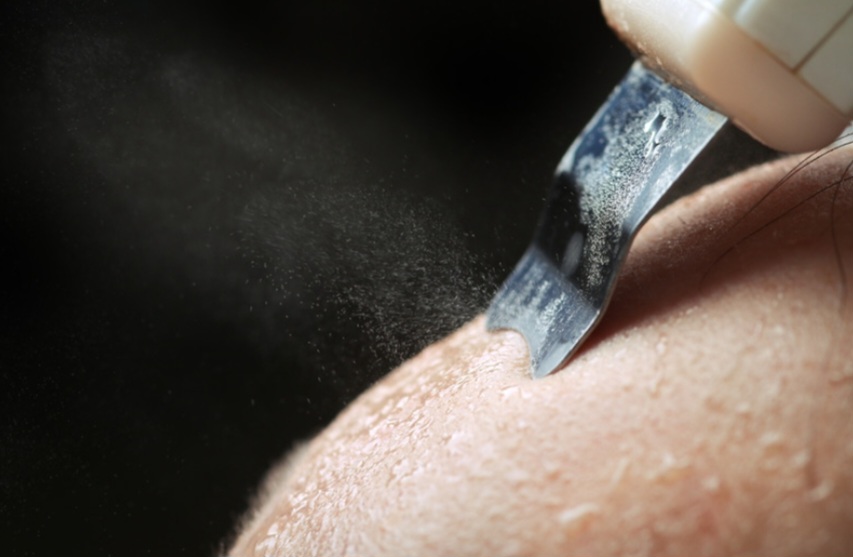 Ultrasonic Spatula Facial