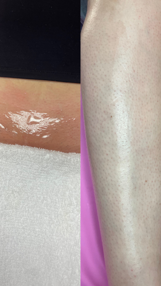 Brazillian Wax/ Leg Wax Combo