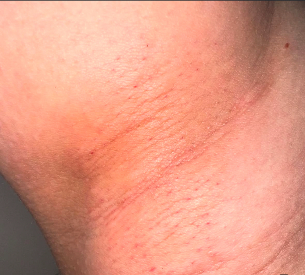 Armpit Wax