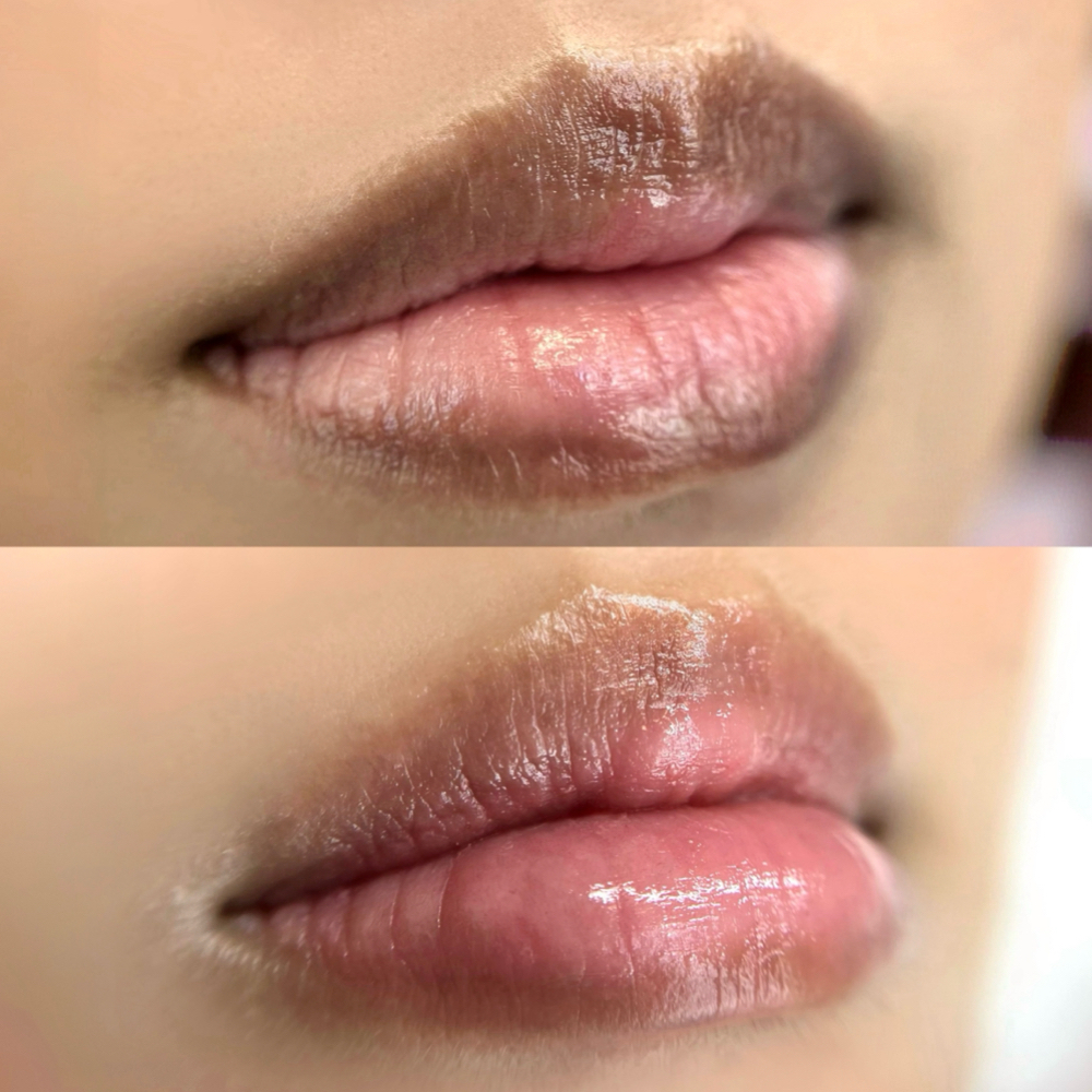 Lip Blush & Neutralization at Cocoa Square in Grapevine, TX