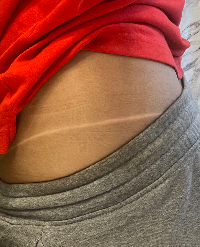 Spray Tan