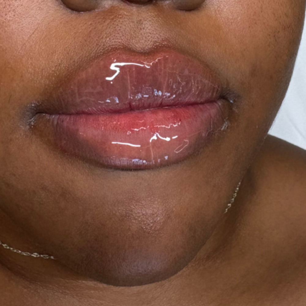 OCTOBER MONDAY LIP SPECIAL at Eluxy Aesthetics in Arlington, TX