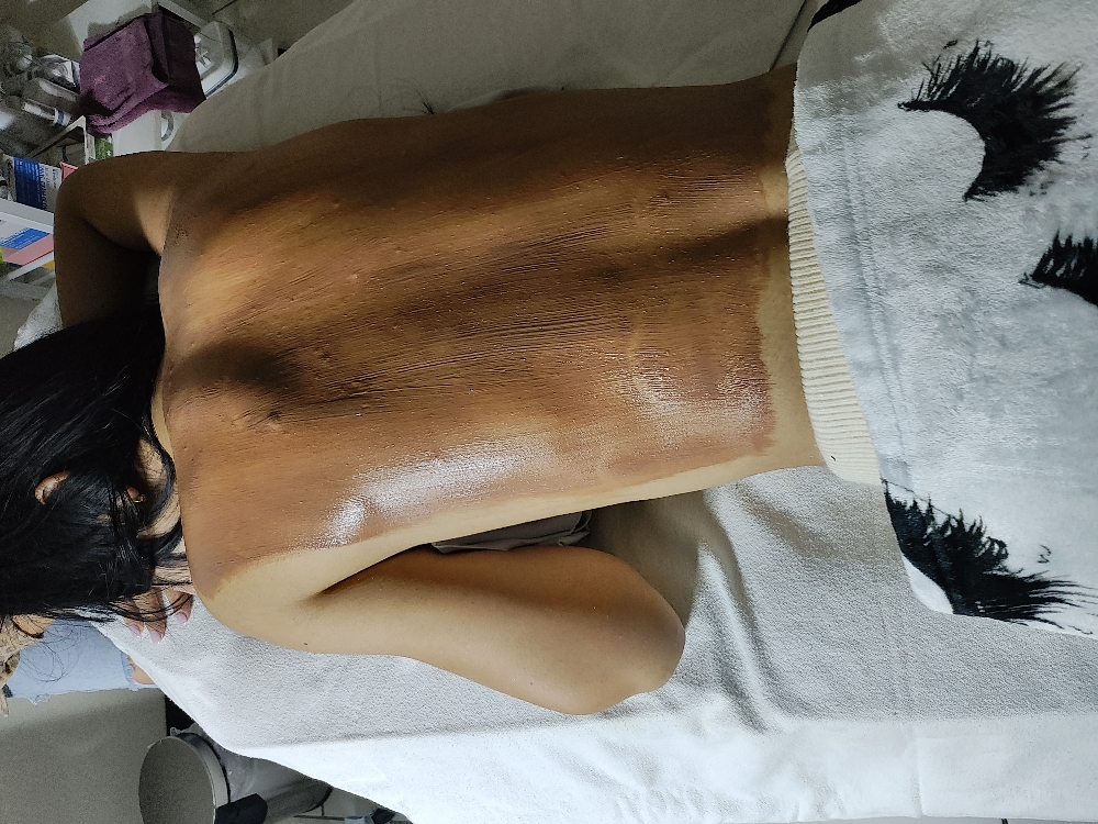 Back Facial at Simply Posh Face and Body Spa in Harlingen, TX