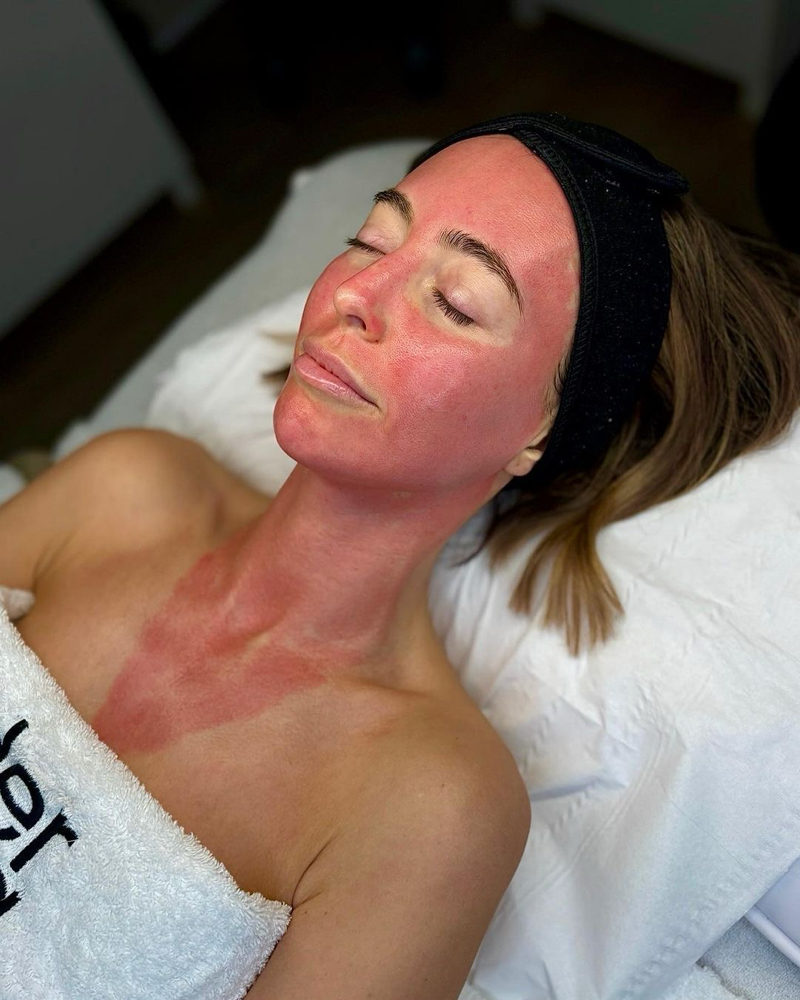 Neck + Décolleté  - ADD ON at The Esthetician Lab in West Chester, OH