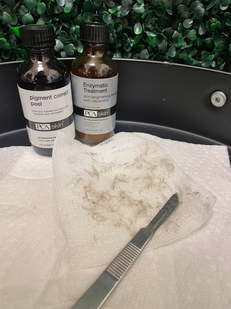 Dermaplaning Add On
