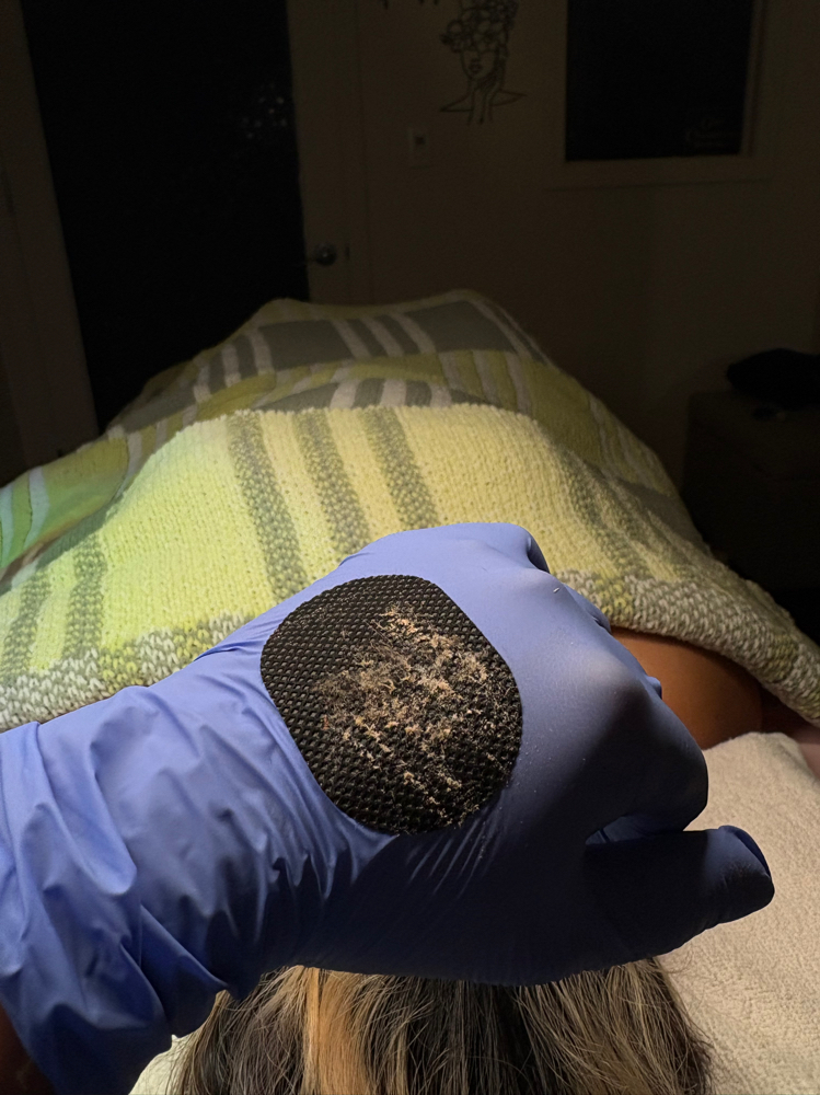 Dermaplaning Add On