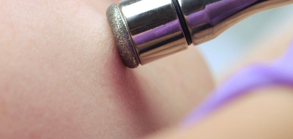Body Diamond Microdermabrasion