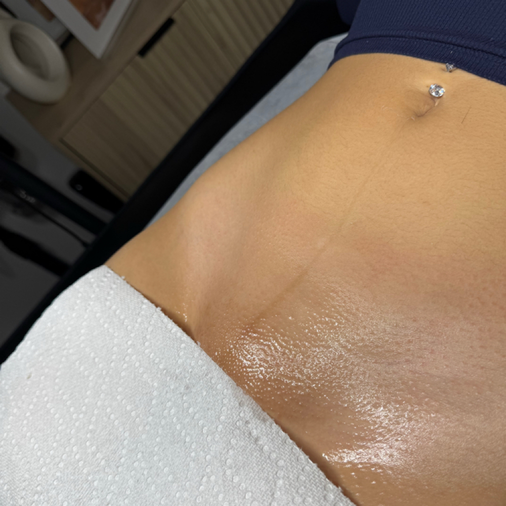 Returning Client: Brazilian Wax