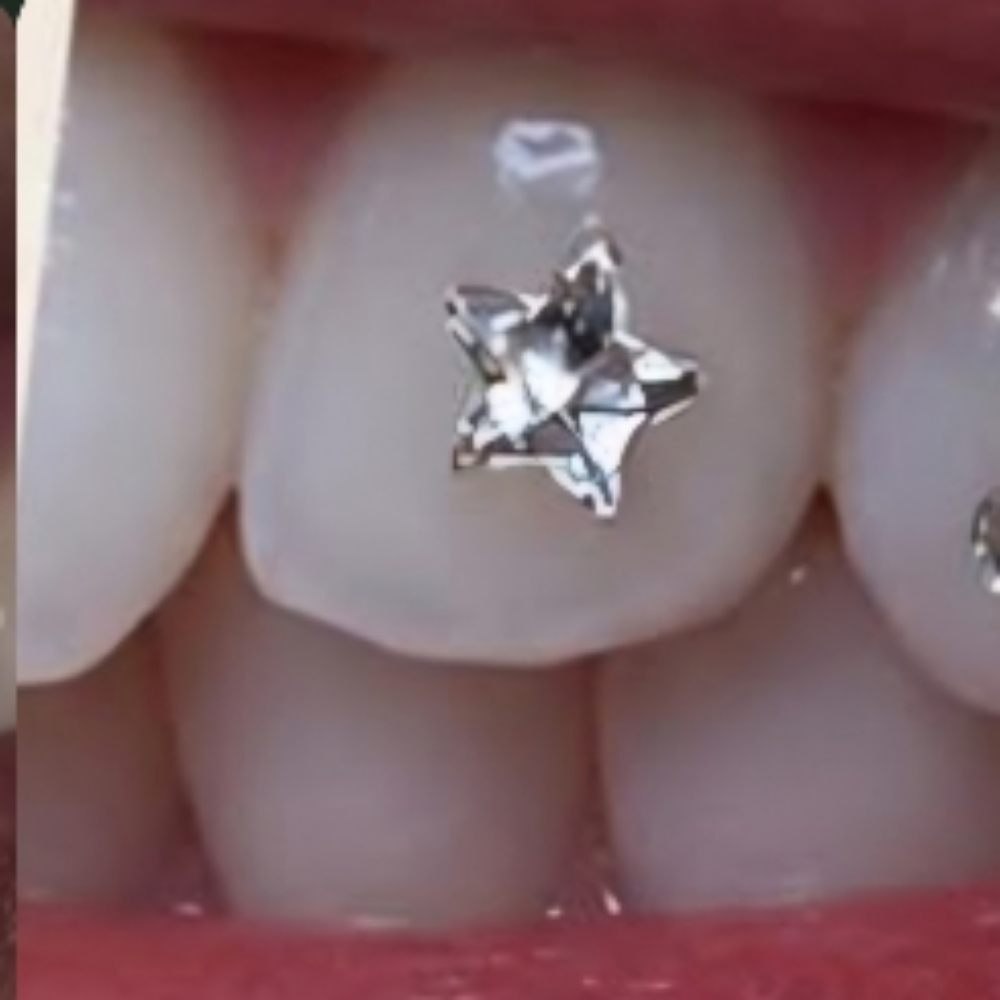 Additional Shaped Gems at Teeth Whitening Lounge in Santa Ana, CA
