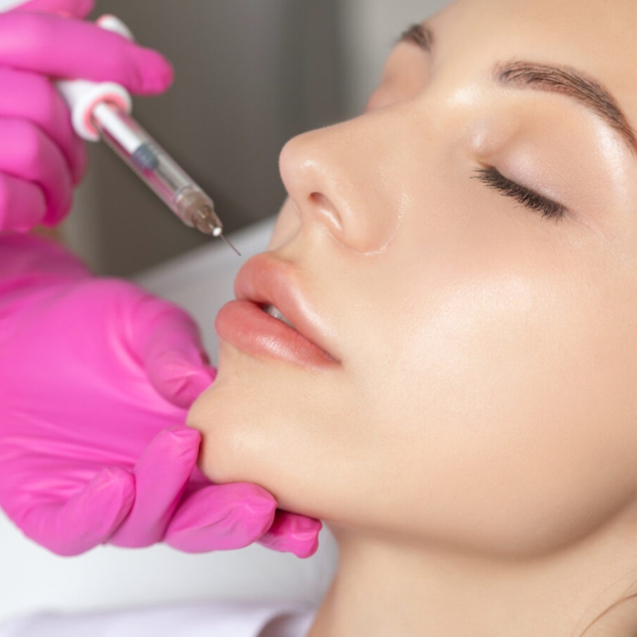 Botox — Gummy Smile at JENNVIE Med Spa in Westport, CT