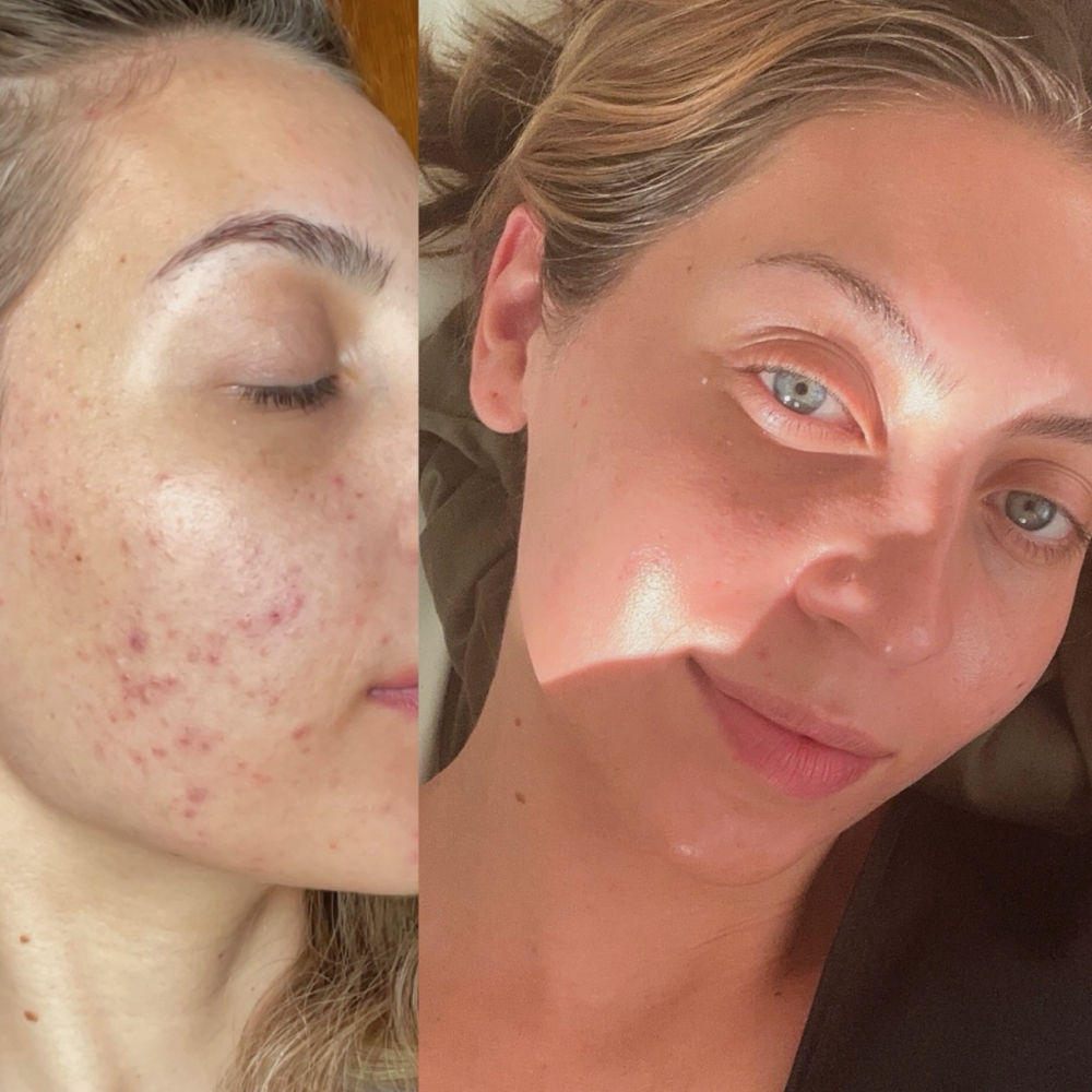 Face Reality Consult + Treatment
