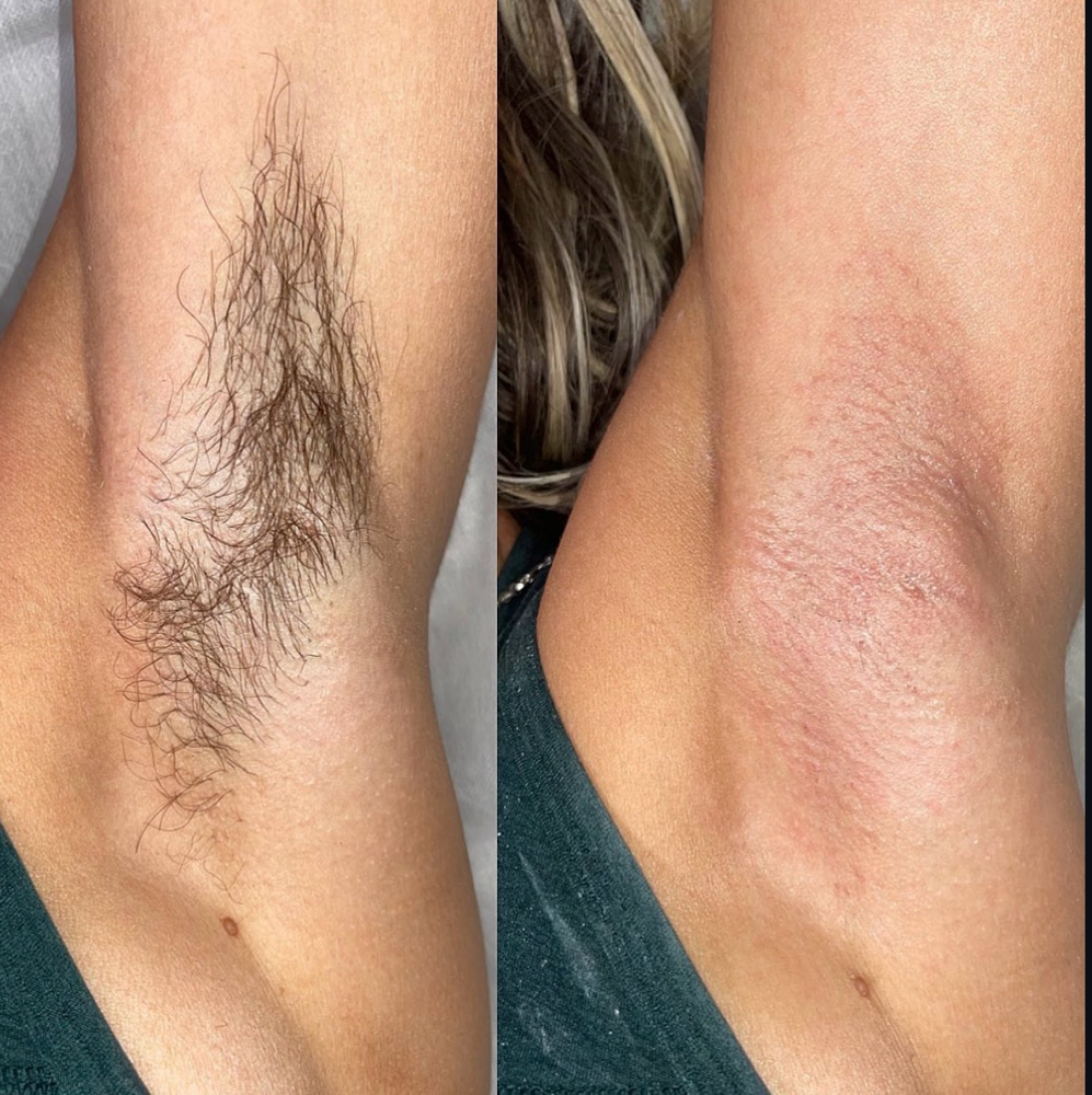 Underarm Wax