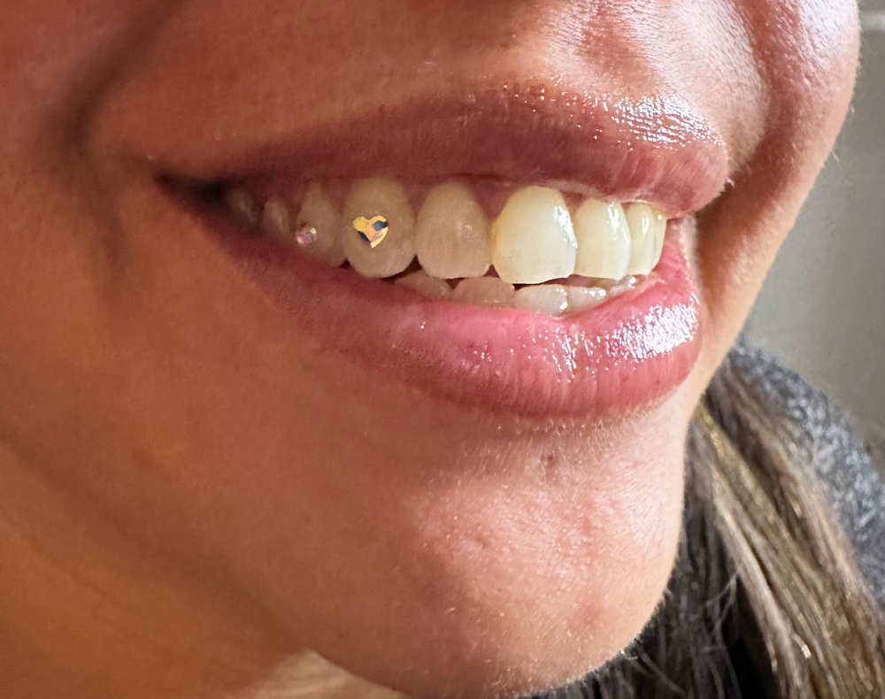 Heart Shaped Tooth Gem
