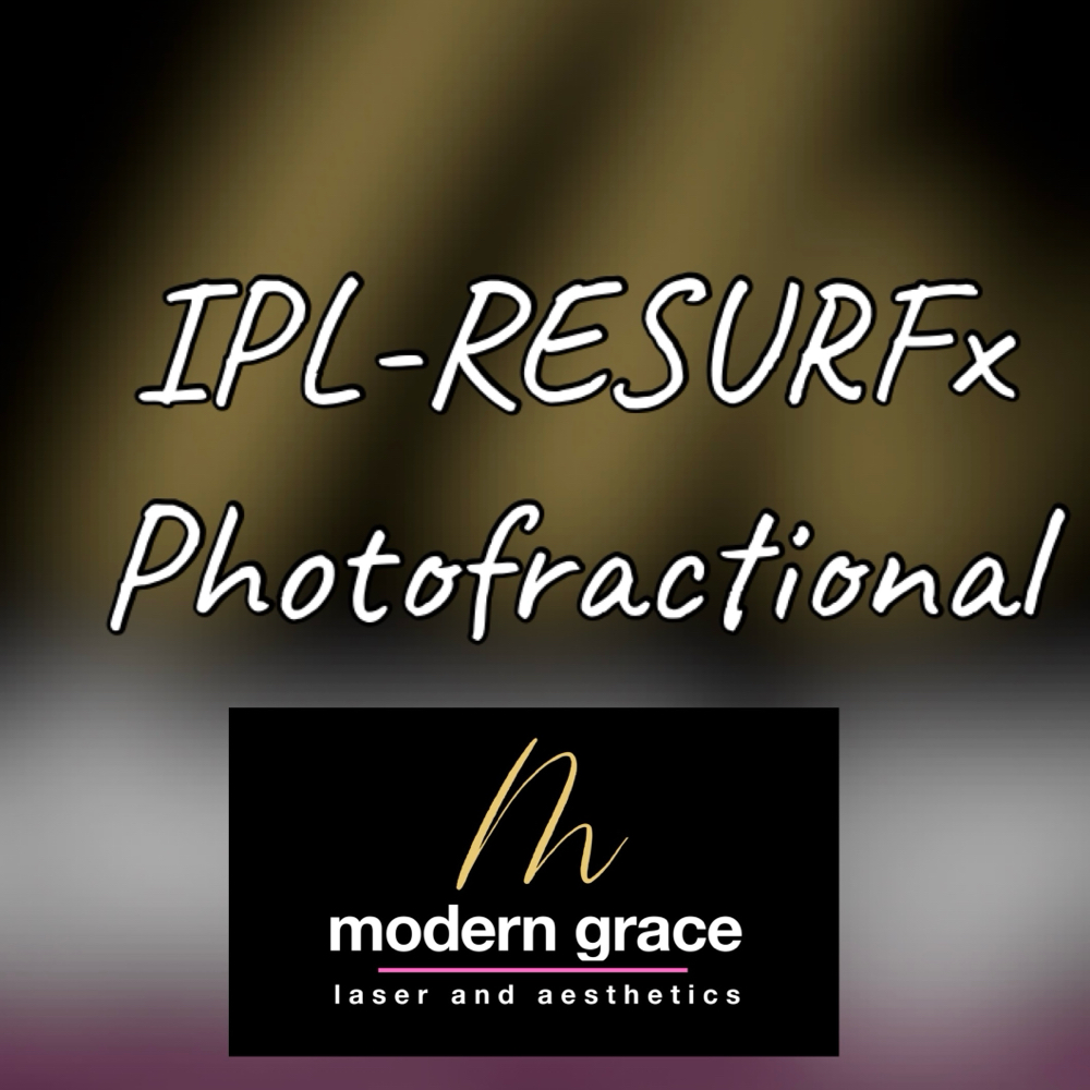 Photofractional- (IPL& Resurfx) at Modern Grace Laser and Aesthetics in San Tan Valley, AZ