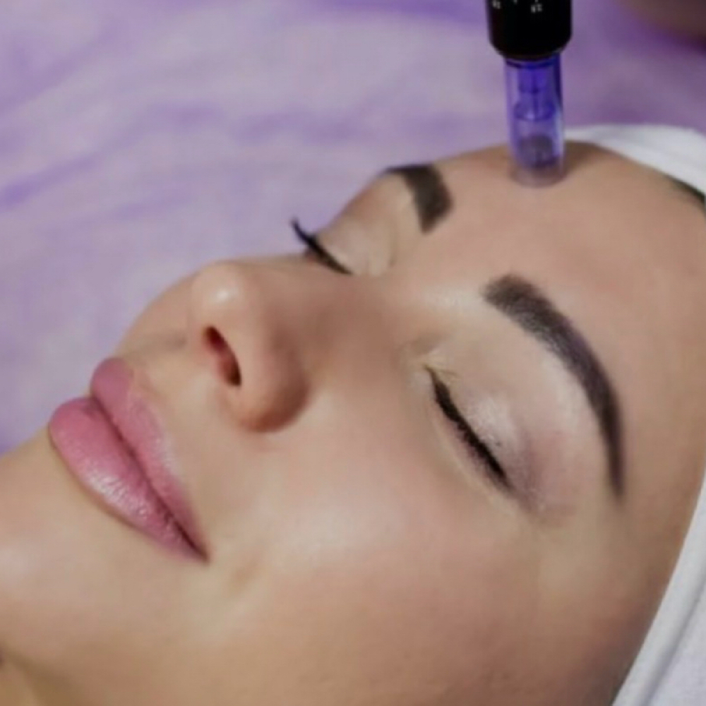 HA Microneedling Treatment at Graceful Skin Aesthetics LLC in Glendale, AZ