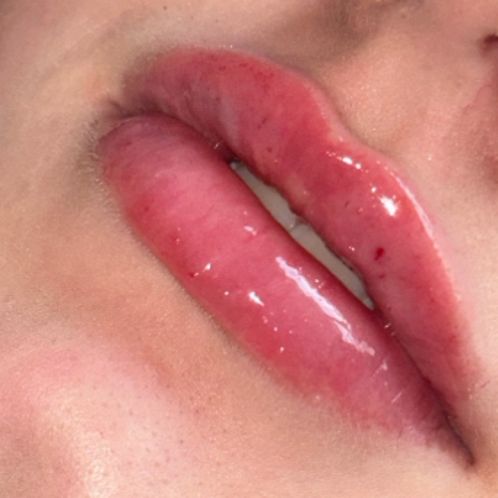 Collagen-Boosting Lip Treatment